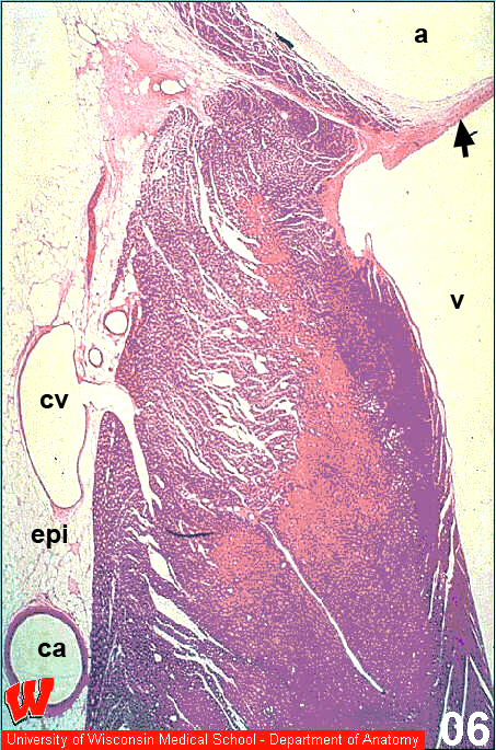 Cv10o