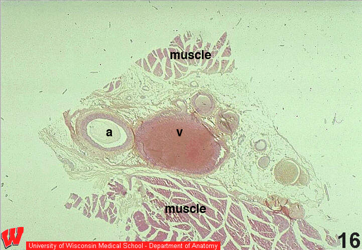 Cv21o