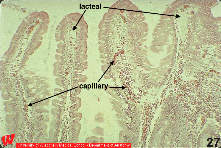 Cv27o