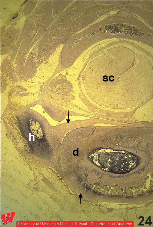 Ct24o