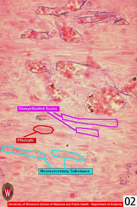 Endocrine02l