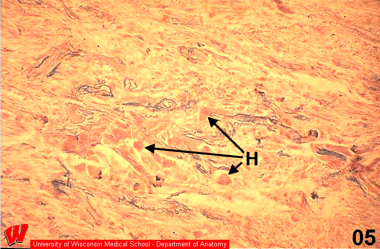 Endocrine05o