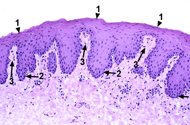 Epith14oanew