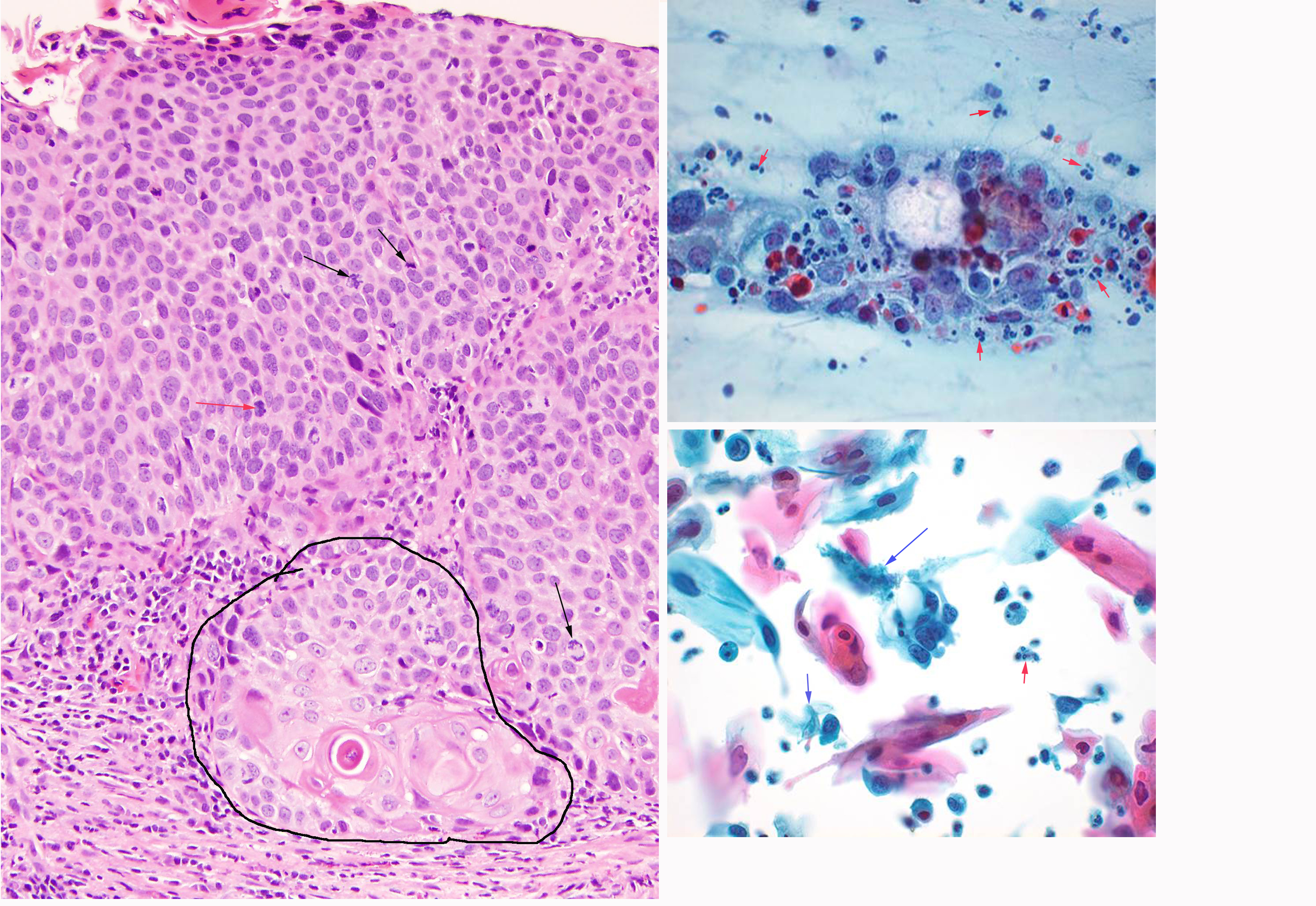 Ha4.invasive.annot