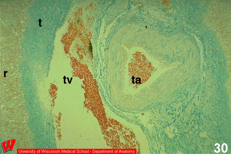 Immune23o