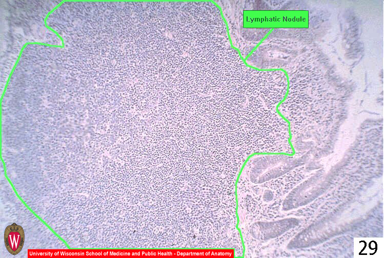 Immune29l