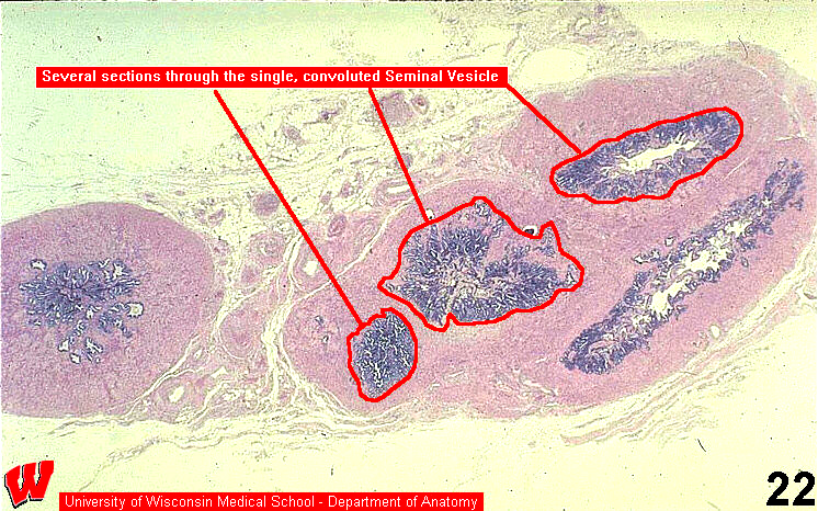 Male10l