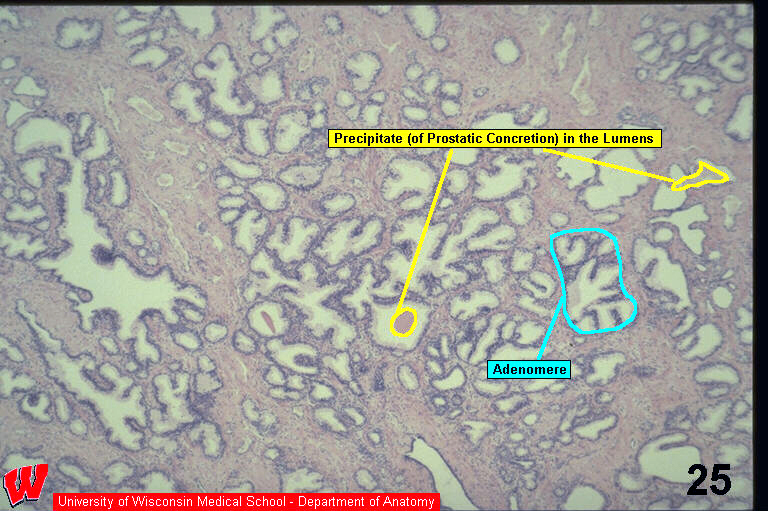 Male12l