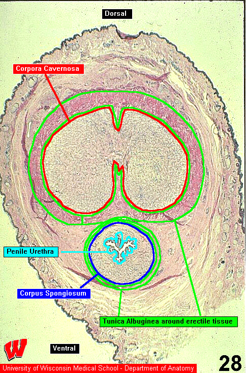 Male14l